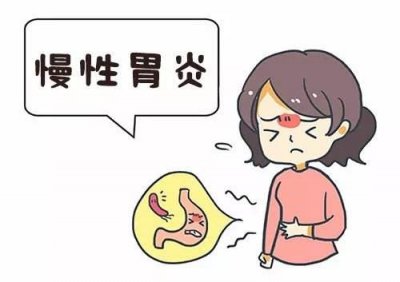 治療慢性胃炎需要多少錢